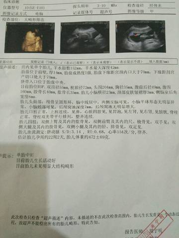 journal_insert_pic_740668305