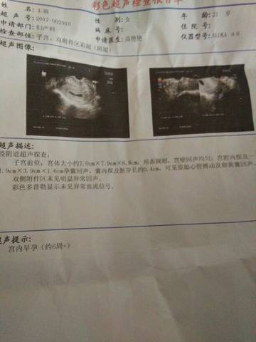 journal_insert_pic_742327767