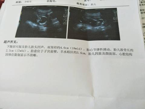 journal_insert_pic_743052048