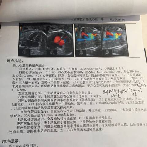 journal_insert_pic_745370942