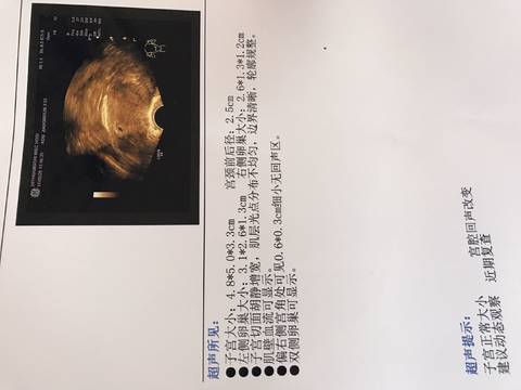 journal_insert_pic_746177894