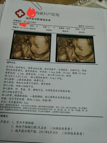 journal_insert_pic_750156199