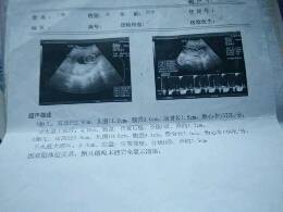 journal_insert_pic_750212948