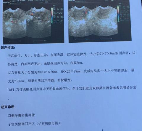 journal_insert_pic_751309062