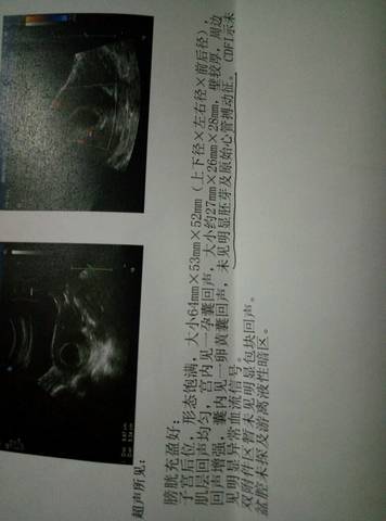 journal_insert_pic_753244626