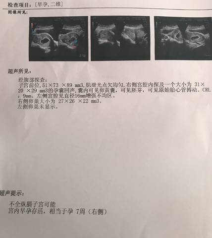 journal_insert_pic_752973446