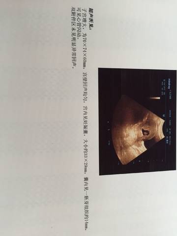 journal_insert_pic_755159441