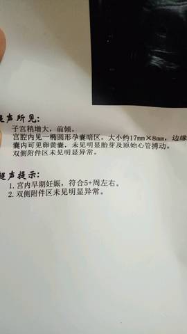 journal_insert_pic_757180643