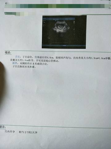 journal_insert_pic_758652188