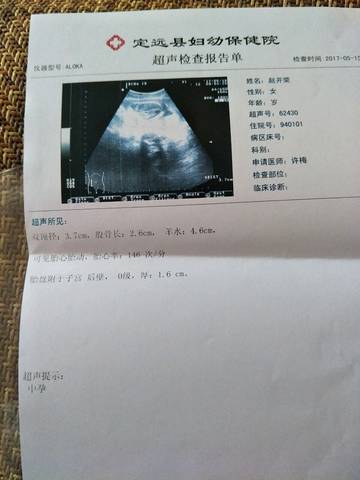 journal_insert_pic_761007159