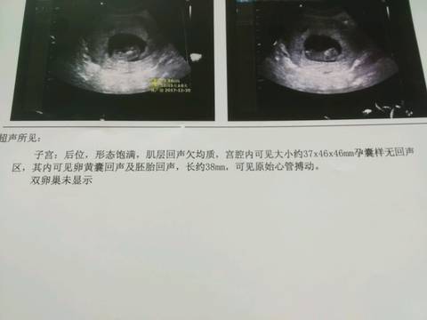 journal_insert_pic_761748965