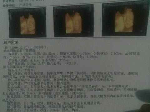 journal_insert_pic_761342357