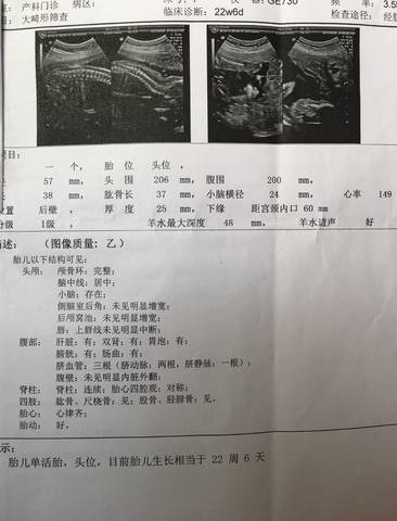 journal_insert_pic_764170995
