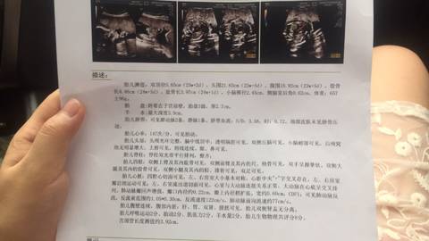journal_insert_pic_768000944