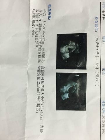 journal_insert_pic_770731086