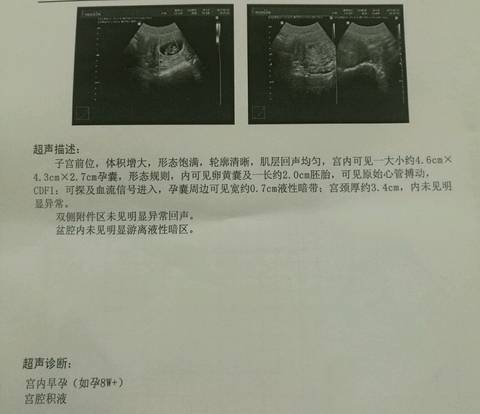 journal_insert_pic_771337713