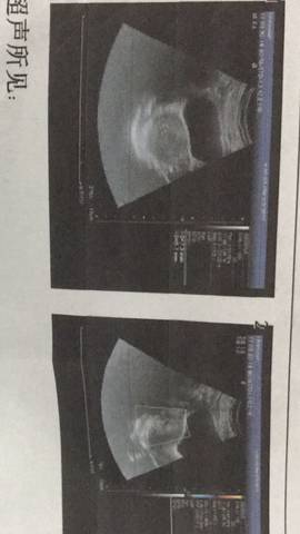 journal_insert_pic_771027415