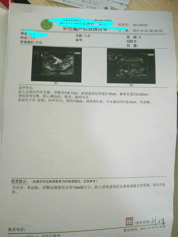 journal_insert_pic_771023877