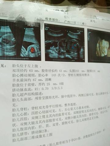 journal_insert_pic_772106381