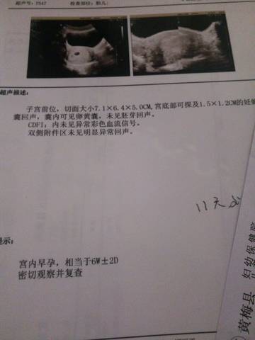 journal_insert_pic_772102683