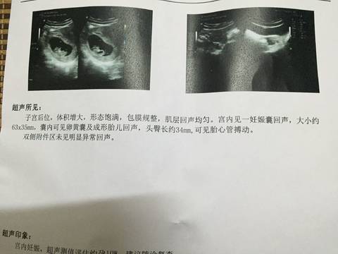 journal_insert_pic_774287845