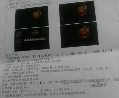 journal_insert_pic_775505276