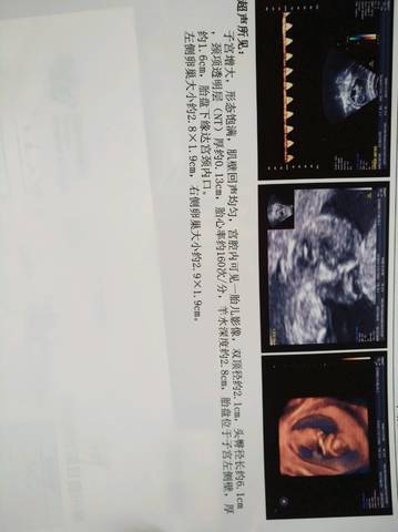 journal_insert_pic_776603992