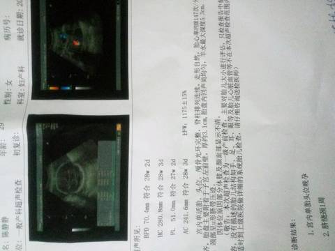journal_insert_pic_781758331