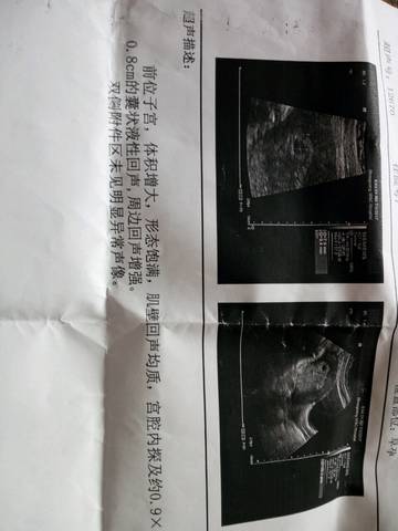 journal_insert_pic_781746647