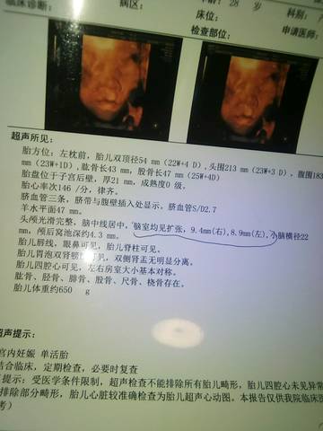 journal_insert_pic_787833622
