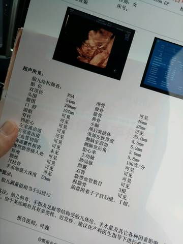 journal_insert_pic_788517340