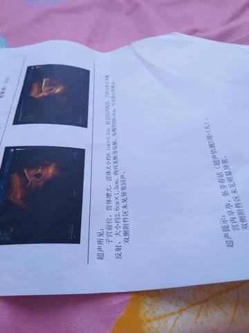 journal_insert_pic_788605572