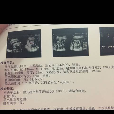 journal_insert_pic_790199700