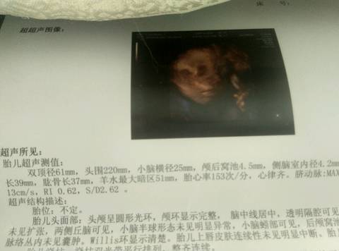 journal_insert_pic_791431316