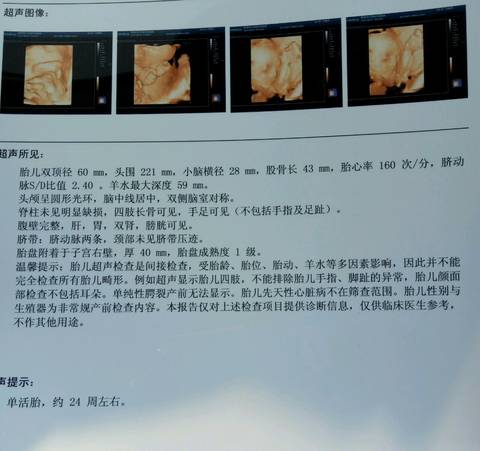 journal_insert_pic_794587356