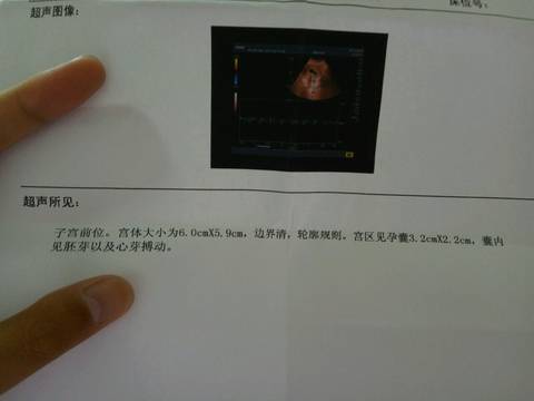 journal_insert_pic_794587312
