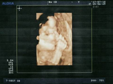 journal_insert_pic_795202918