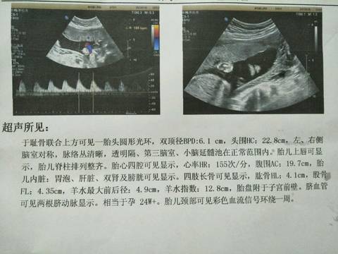 journal_insert_pic_795202935