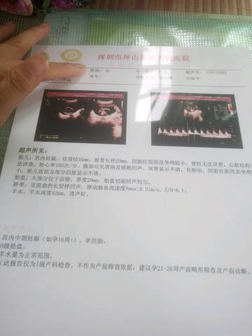 journal_insert_pic_794976724