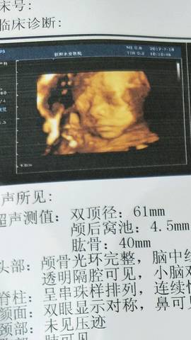 journal_insert_pic_794863367