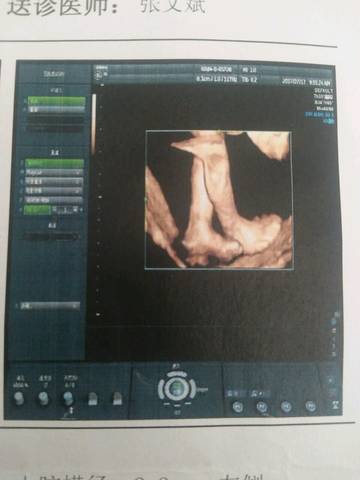 journal_insert_pic_796025000