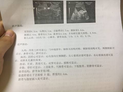journal_insert_pic_796460445