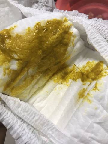 帮忙看看宝宝拉的粑粑正常吗?