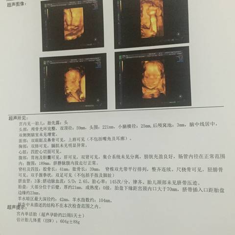 journal_insert_pic_799694041
