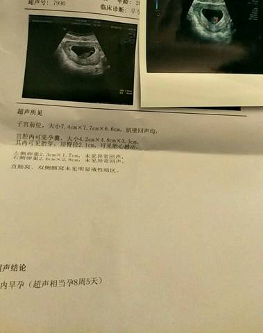 journal_insert_pic_800097507