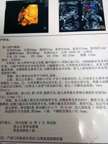 journal_insert_pic_800896156