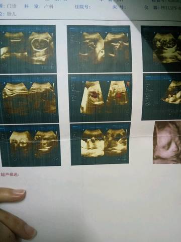 journal_insert_pic_803555230