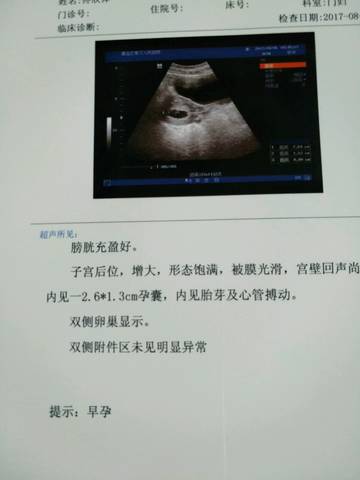 journal_insert_pic_809081558