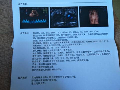 journal_insert_pic_809300671