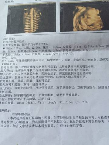 journal_insert_pic_809047605